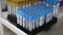 Проверяться на гепатит C нужно ежегодно — минздрав Ставрополья  